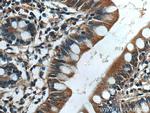 ASB13 Antibody in Immunohistochemistry (Paraffin) (IHC (P))