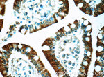 MUPCDH Antibody in Immunohistochemistry (Paraffin) (IHC (P))