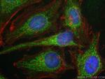 NDUFAF3 Antibody in Immunocytochemistry (ICC/IF)