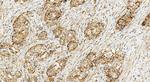 NDUFAF3 Antibody in Immunohistochemistry (Paraffin) (IHC (P))