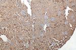 KIAA0317 Antibody in Immunohistochemistry (Paraffin) (IHC (P))