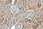 KIAA0317 Antibody in Immunohistochemistry (Paraffin) (IHC (P))