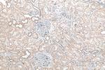 KIAA0317 Antibody in Immunohistochemistry (Paraffin) (IHC (P))