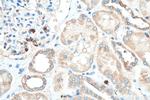 KIAA0317 Antibody in Immunohistochemistry (Paraffin) (IHC (P))