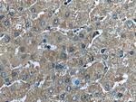 CHCHD3 Antibody in Immunohistochemistry (Paraffin) (IHC (P))
