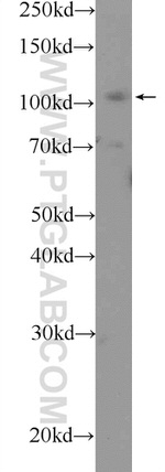 RB1 Antibody in Western Blot (WB)