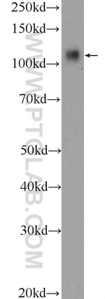 RB1 Antibody in Western Blot (WB)