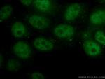RB1 Antibody in Immunocytochemistry (ICC/IF)