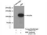 RB1 Antibody in Immunoprecipitation (IP)