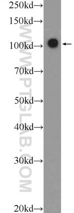RB1 Antibody in Western Blot (WB)