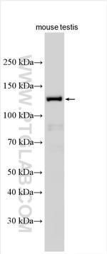 ODAD2 Antibody in Western Blot (WB)