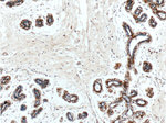 Mammaglobin A Antibody in Immunohistochemistry (Paraffin) (IHC (P))