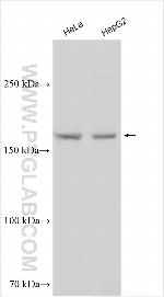 TARBP1 Antibody in Western Blot (WB)