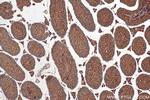 PTPN20A Antibody in Immunohistochemistry (Paraffin) (IHC (P))