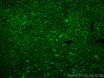 PTPN20A Antibody in Immunohistochemistry (PFA fixed) (IHC (PFA))