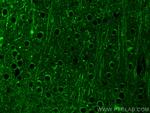 PTPN20A Antibody in Immunohistochemistry (PFA fixed) (IHC (PFA))