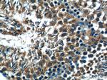 C19orf36 Antibody in Immunohistochemistry (Paraffin) (IHC (P))