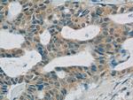 C11orf83 Antibody in Immunohistochemistry (Paraffin) (IHC (P))