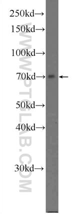KIAA1279 Antibody in Western Blot (WB)