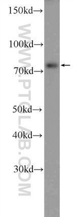 KIAA1279 Antibody in Western Blot (WB)
