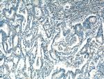 DENND1A Antibody in Immunohistochemistry (Paraffin) (IHC (P))