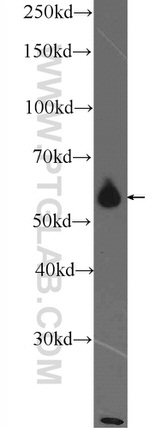 PKM Antibody in Western Blot (WB)