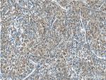 PKM Antibody in Immunohistochemistry (Paraffin) (IHC (P))