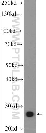 LRRC29 Antibody in Western Blot (WB)