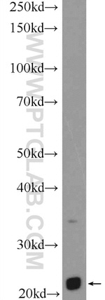 LRRC29 Antibody in Western Blot (WB)