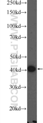MARVELD3 Antibody in Western Blot (WB)