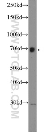 ZNF668 Antibody in Western Blot (WB)