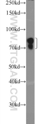 ZNF668 Antibody in Western Blot (WB)