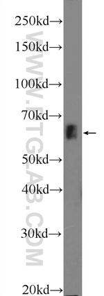 ZNF668 Antibody in Western Blot (WB)