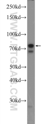 ZNF668 Antibody in Western Blot (WB)