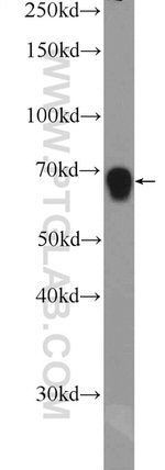 ZNF668 Antibody in Western Blot (WB)