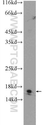 CHCHD10 Antibody in Western Blot (WB)