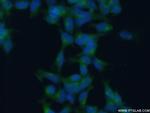 GGA1 Antibody in Immunocytochemistry (ICC/IF)