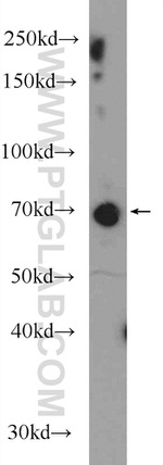 GGA1 Antibody in Western Blot (WB)