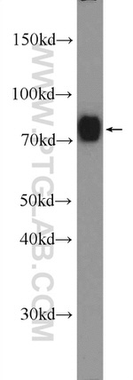 GGA1 Antibody in Western Blot (WB)