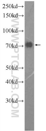 GGA1 Antibody in Western Blot (WB)