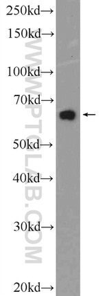 GATAD2B Antibody in Western Blot (WB)