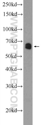 GATAD2B Antibody in Western Blot (WB)