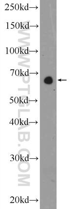 GATAD2B Antibody in Western Blot (WB)