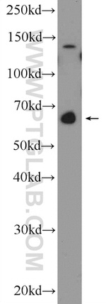 GATAD2B Antibody in Western Blot (WB)
