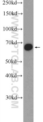 GATAD2B Antibody in Western Blot (WB)