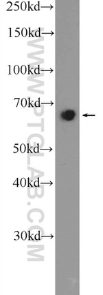 GATAD2B Antibody in Western Blot (WB)