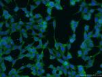 SPTBN1 Antibody in Immunocytochemistry (ICC/IF)