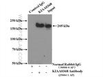 KIAA0368 Antibody in Immunoprecipitation (IP)