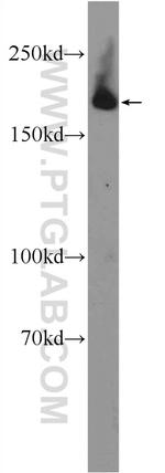 KIAA0368 Antibody in Western Blot (WB)