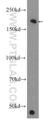 KIAA0368 Antibody in Western Blot (WB)